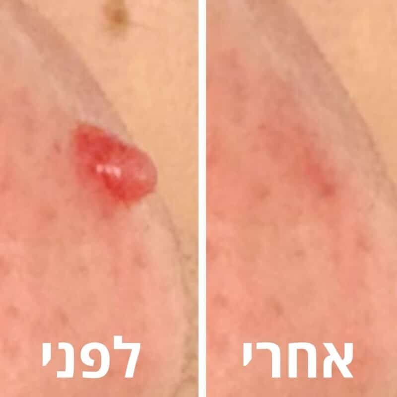 לפני ואחרי